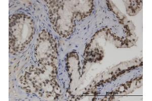 Immunoperoxidase of monoclonal antibody to ZNF3 on formalin-fixed paraffin-embedded human prostate. (ZNF3 antibody  (AA 1-110))