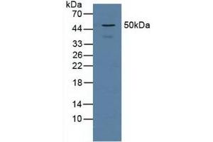 Figure. (Proteasome 26S Subunit, Non ATPase 5 (AA 143-341) antibody)