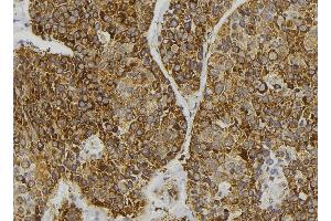 ABIN6276625 at 1/100 staining Human pancreas tissue by IHC-P. (GIPC2 antibody  (C-Term))