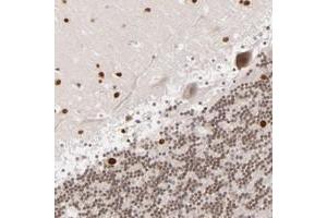 Immunohistochemical staining of human cerebellum with RP13-102H201 polyclonal antibody  shows nuclear positivity in purkinje cells, cells in molecular layer and cells in granular layer at 1:10-1:20 dilution. (ARHGAP36 antibody)