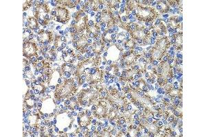Immunohistochemistry of paraffin-embedded Rat kidney using COPS2 Polyclonal Antibody at dilution of 1:100 (40x lens). (COPS2 antibody)