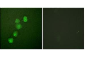 Immunofluorescence analysis of HuvEc cells, using Cyclin E1 (epitope around residue 395) antibody (ABIN5976158).