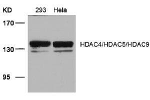 Image no. 3 for anti-HDAC4,HDAC5,HDAC9 (Ser220), (Ser246), (Ser259) antibody (ABIN319390) (HDAC4/HDAC5/HDAC9 antibody  (Ser220, Ser246, Ser259))