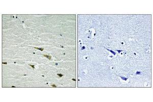 Immunohistochemical analysis of paraffin-embedded human brain tissue using Trk A (Phospho-Tyr757) antibody (left)or the same antibody preincubated with blocking peptide (right).