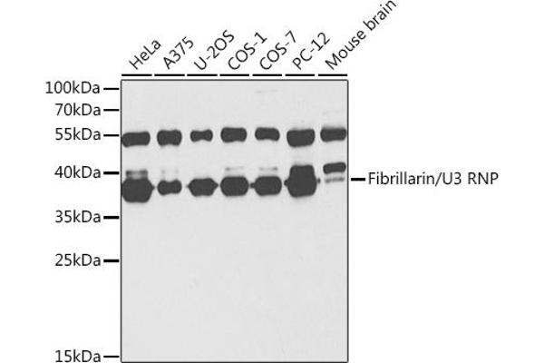 Fibrillarin antibody  (AA 100-321)