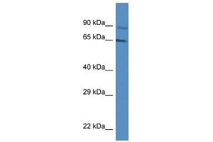 Western Blot showing MUS81 antibody used at a concentration of 1 ug/ml against Jurkat Cell Lysate