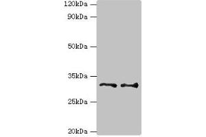Western blot All lanes: Tumor necrosis factor receptor superfamily member 27 antibody at 6 μg/mL Lane 1: HepG2 whole cell lysate Lane 2: Hela whole cell lysate Secondary Goat polyclonal to rabbit IgG at 1/10000 dilution Predicted band size: 33, 36 kDa Observed band size: 33 kDa (Ectodysplasin A2 Receptor antibody  (AA 1-138))