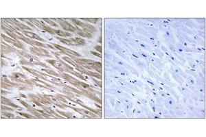 Immunohistochemistry analysis of paraffin-embedded human heart tissue, using KANK2 Antibody. (KANK2 antibody  (AA 351-400))