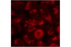Image no. 2 for anti-Heat Shock Protein 90kDa alpha (Cytosolic), Class B Member 1 (HSP90AB1) (Ser254) antibody (ABIN197568) (HSP90AB1 antibody  (Ser254))