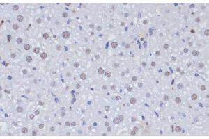 Immunohistochemistry of paraffin-embedded Rat liver using PCNA Polyclonal Antibody at dilution of 1:100 (40x lens). (PCNA antibody)