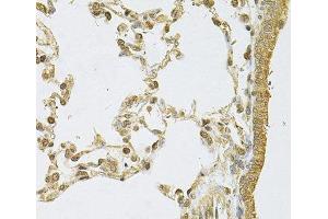 Immunohistochemistry of paraffin-embedded Rat lung using PSMA5 Polyclonal Antibody at dilution of 1:100 (40x lens).