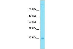 Host: Rabbit Target Name: C7orf49 Sample Type: MDA-MB-435S Whole Cell lysates Antibody Dilution: 1. (C7orf49 antibody  (N-Term))