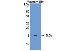 Western Blotting (WB) image for anti-TIMP Metallopeptidase Inhibitor 1 (TIMP1) (AA 35-160) antibody (ABIN1173100) (TIMP1 antibody  (AA 35-160))