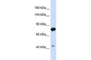 Host:  Rabbit  Target Name:  CDH23  Sample Type:  Fetal Brain lysates  Antibody Dilution:  1. (CDH23 antibody  (N-Term))