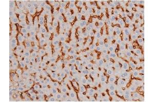 Immunohistochemistry (IHC) image for anti-Microtubule-Associated Protein tau (MAPT) (pThr181) antibody (ABIN6255614)