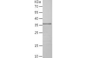 DLL4 Protein (AA 558-685) (His-IF2DI Tag)