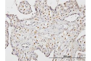 Immunoperoxidase of monoclonal antibody to STK33 on formalin-fixed paraffin-embedded human placenta. (STK33 antibody  (AA 1-514))