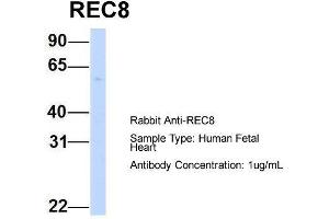 Host:  Rabbit  Target Name:  REC8  Sample Type:  Human Fetal Heart  Antibody Dilution:  1. (REC8 antibody  (N-Term))
