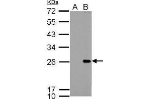 WB Image Bcl-2 antibody detects Bcl-2 protein by Western blot analysis. (Bcl-2 antibody  (N-Term))