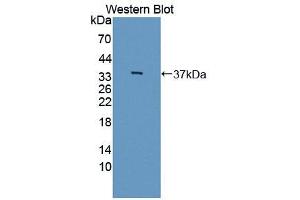 Western blot analysis of the recombinant protein. (IL12B antibody  (AA 23-329))