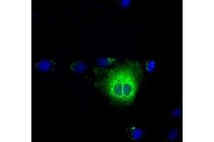 Anti-TBXAS1 mouse monoclonal antibody (ABIN2453709) immunofluorescent staining of COS7 cells transiently transfected by pCMV6-ENTRY TBXAS1 (RC208028). (TBXAS1 antibody)