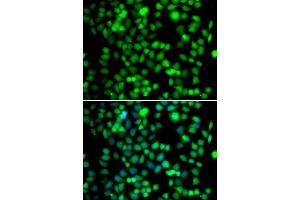 Immunofluorescence analysis of U2OS cells using FKBP6 antibody (ABIN5974220). (FKBP6 antibody)