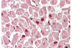 Rabbit Anti-Mxi1 antibody  Formalin Fixed Paraffin Embedded Tissue: Human Heart Primary antibody Concentration: 1:200 Secondary Antibody: Donkey anti-Rabbit-Cy3 Secondary Antibody Concentration: 1:200 Magnification: 20x Exposure Time: 0. (MXI1 antibody  (N-Term))