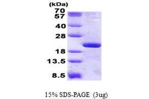 Image no. 1 for Ribosomal Protein L12 (RPL12) protein (His tag) (ABIN1098547) (RPL12 Protein (His tag))