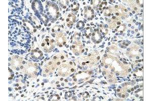 Image no. 1 for anti-Calcium Channel, Voltage-Dependent, beta 1 Subunit (CACNB1) (AA 201-250) antibody (ABIN6736600) (CACNB1 antibody  (AA 201-250))