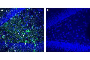 Expression of TMEM106B in mouse hippocampus.