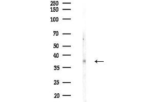 anti-Cyclin D1 (CCND1) (C-Term) antibody