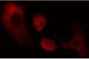 ABIN6274966 staining Hela cells by IF/ICC. (CES2 antibody  (N-Term))