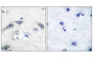 Immunohistochemistry (IHC) image for anti-Protein Phosphatase 1, Regulatory (Inhibitor) Subunit 1B (PPP1R1B) (Thr75) antibody (ABIN7180002)