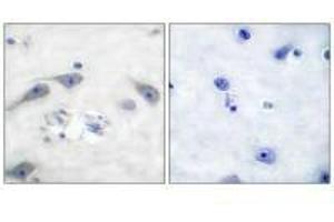 Immunohistochemical analysis of paraffin-embedded human brain tissue using DARPP-32 (Ab-75) antibody. (DARPP32 antibody  (Thr75))