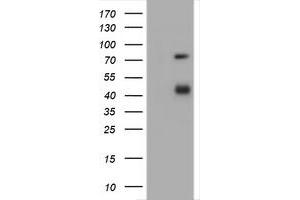 Image no. 1 for anti-CD2 (CD2) antibody (ABIN1497197) (CD2 antibody)
