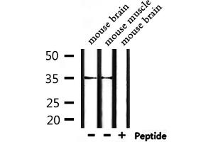 Western blot analysis of extracts from mouse brain and mouse muscle, using OR52P1 Antibody.