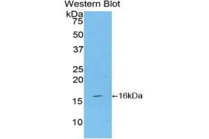 Western blot analysis of the recombinant protein. (CD70 antibody  (AA 64-192))