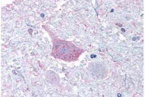 Immunohistochemical staining of human brain, medulla with MRGPRD polyclonal antibody .