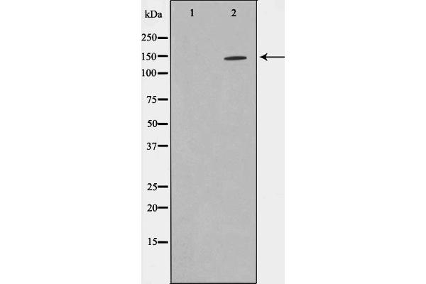ZMYND8 antibody  (Internal Region)