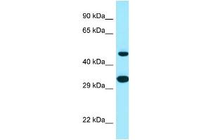 Western Blotting (WB) image for anti-Stearoyl-CoA Desaturase 5 (SCD5) (C-Term) antibody (ABIN2790026) (SCD5 antibody  (C-Term))