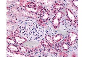 Anti-GPR91 antibody IHC of human kidney. (SUCNR1 antibody  (C-Term))