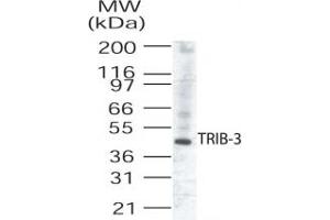 Western Blotting (WB) image for anti-Tribbles Homolog 3 (Drosophila) (TRIB3) (AA 315-332) antibody (ABIN208896) (TRIB3 antibody  (AA 315-332))