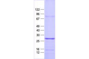 Validation with Western Blot (SCN2B Protein (His tag))