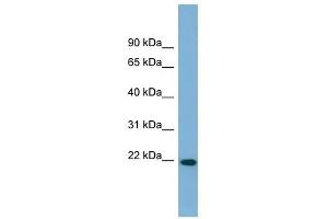 FNDC4 antibody used at 1 ug/ml to detect target protein. (FNDC4 antibody  (Middle Region))