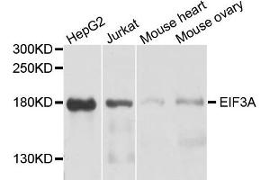 Western blot analysis of extract of various cells, using EIF3A antibody. (EIF3A antibody)