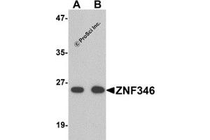 Western Blotting (WB) image for anti-Zinc Finger Protein 346 (ZNF346) (N-Term) antibody (ABIN1031685) (ZNF346 antibody  (N-Term))