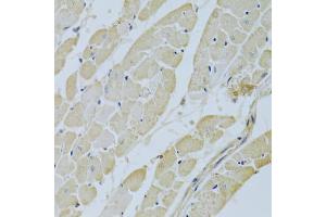 Immunohistochemistry of paraffin-embedded rat heart using CA3 Antibody (ABIN5970554) at dilution of 1/200 (40x lens).