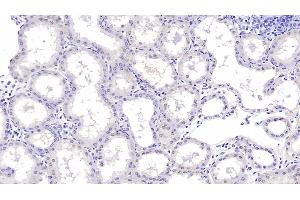 Detection of aHSP in Human Kidney Tissue using Monoclonal Antibody to Alpha-Hemoglobin Stabilizing Protein (aHSP) (aHSP antibody  (AA 1-102))