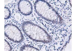 Immunohistochemical staining of paraffin-embedded Human colon tissue using anti-DPP3 mouse monoclonal antibody. (DPP3 antibody)