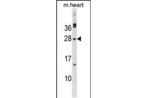 Western blot analysis in mouse heart tissue lysates (35ug/lane). (Musculin antibody  (C-Term))
